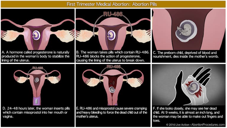 Medical abortion - six panel