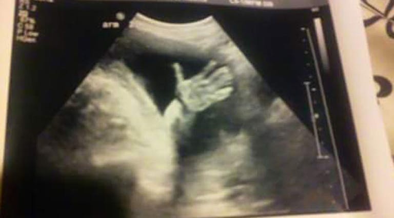 ultrasound-wave-baby