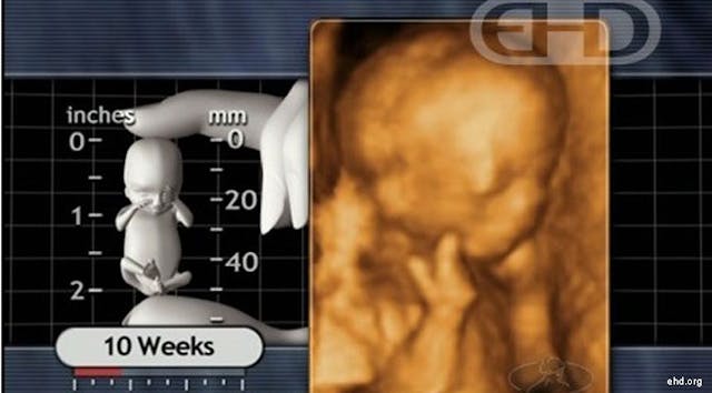 U.S. Senate candidate: When my first child was aborted, it left “a very significant scar on my soul” image