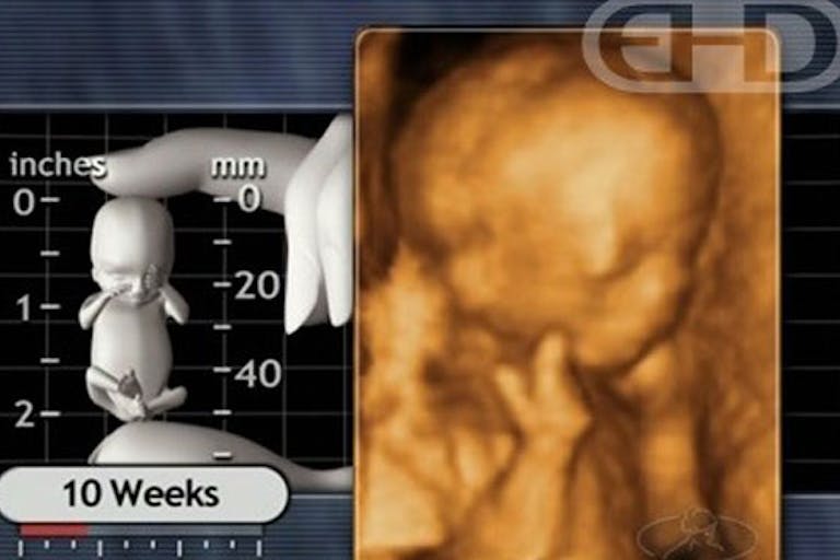 He’s not joking: Abortionist says he’s ‘pro-life,’ compares self to Lincoln and MLK on Comedy Central image
