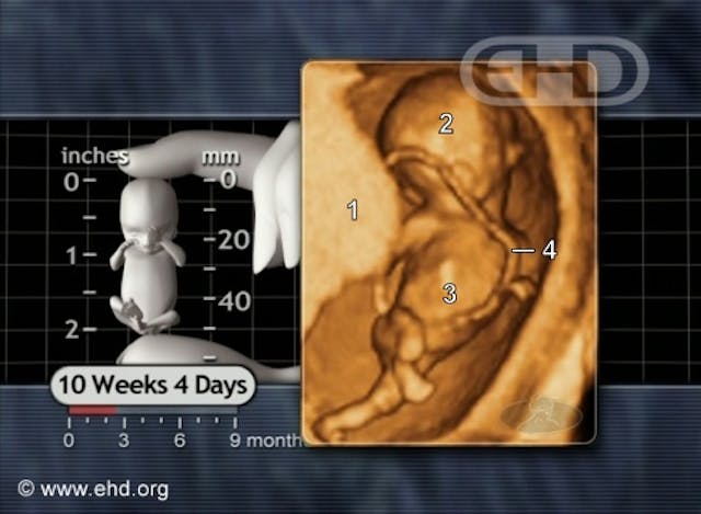 the-sprinter-in-a-hurry