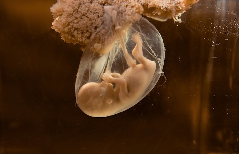 human embryo