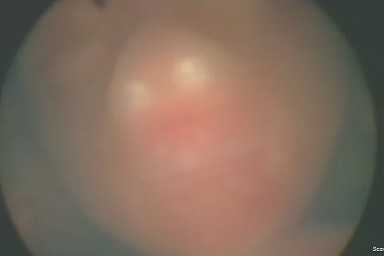 twins-video-screenshot