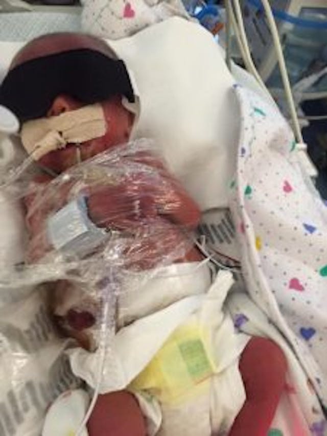 Gideon shortly after birth. photo via Facebook