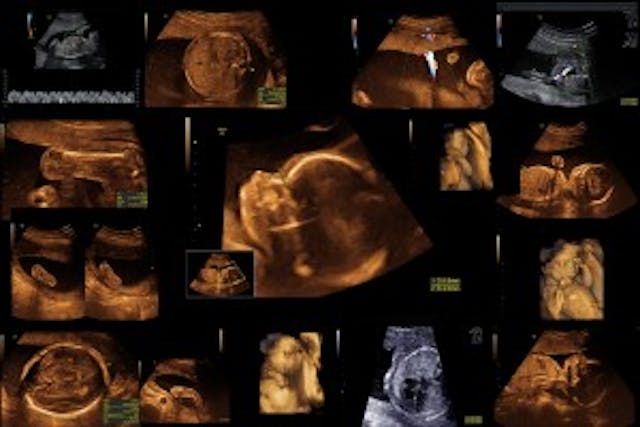 ultrasounds
