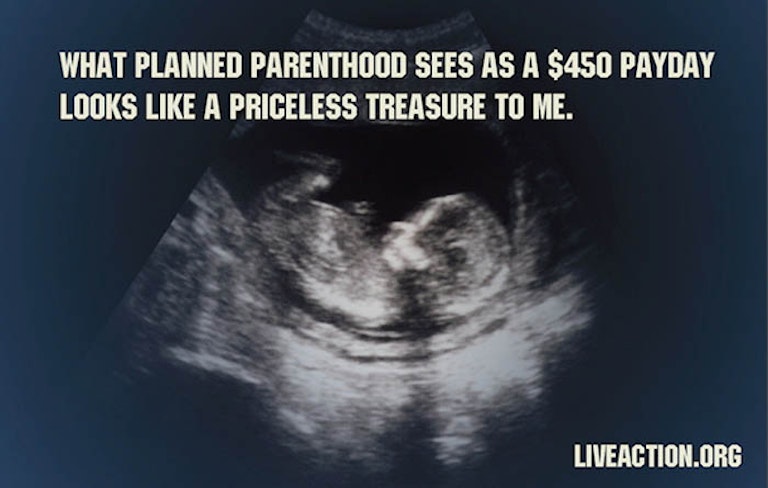 pro-life-graphics-2 (2)
