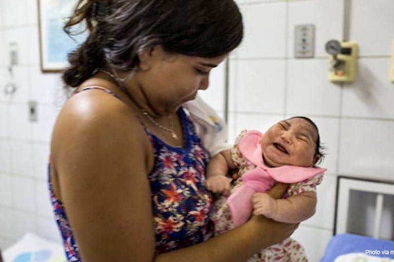 microcephaly-zika