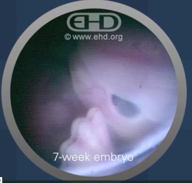 Student who destroyed pro-life display speaks: ‘I engaged my rage’ image