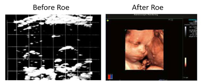 Medical expert: Pelosi should ‘follow the science’ about preborn humans image