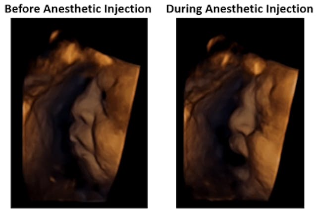 Medical expert: Pelosi should ‘follow the science’ about preborn humans image
