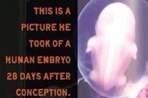 Fetus, baby, 28 days, embryo, conception