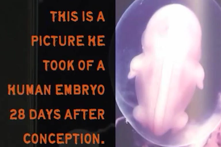 Fetus, baby, 28 days, embryo, conception