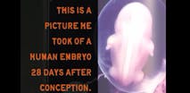 Fetus, baby, 28 days, embryo, conception