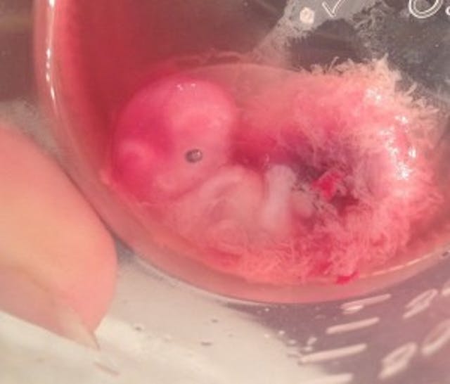 Here’s why abortion is wrong – the science image