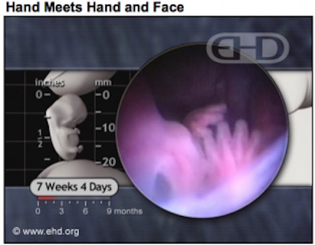 Baby fetus embryo 7 weeks hand face ehd