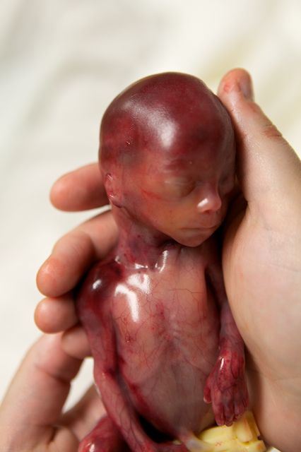 Walter Joshua Fretz who lived 19 weeks.