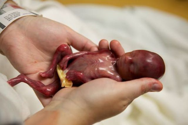 Baby Walter. Baby Walter.