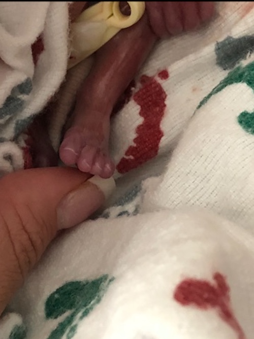 Twin’s foot (Photo by Katelyn McCauley/Ryan Erickson)