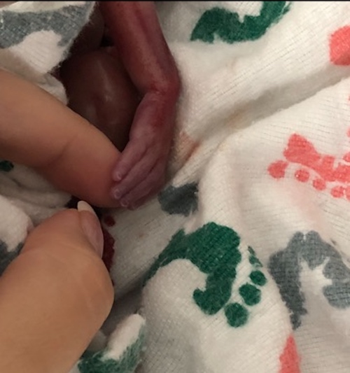 Twin’s hand (Photo by Katelyn McCauley/Ryan Erickson)