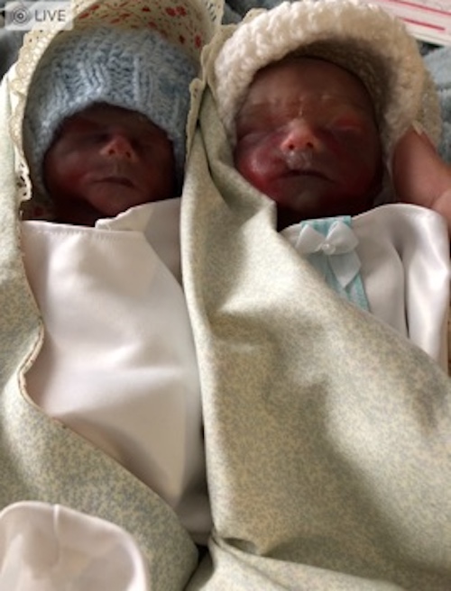 Twins Knox and Gregory (Photo by Katelyn McCauley/Ryan Erickson)