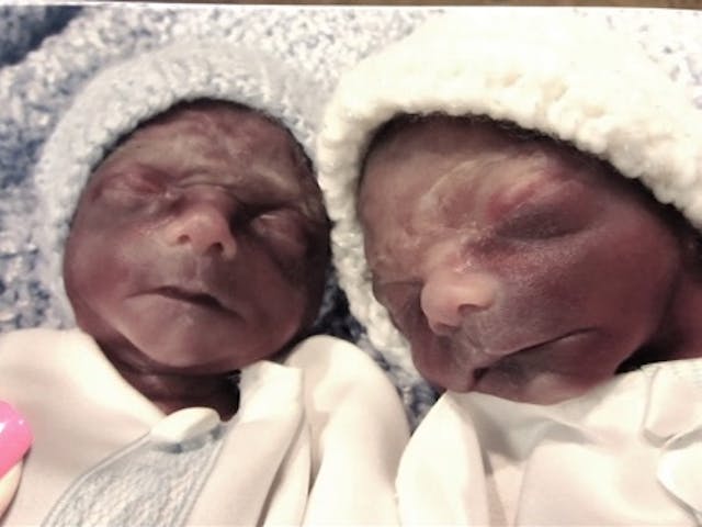 Twins Knox and Gregory (Photo by Katelyn McCauley/Ryan Erickson)