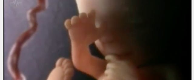 Baby in womb, preborn baby, suck thumb