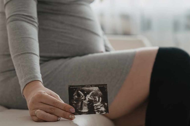 pregnancy, ultrasound, abortions, miscarriage