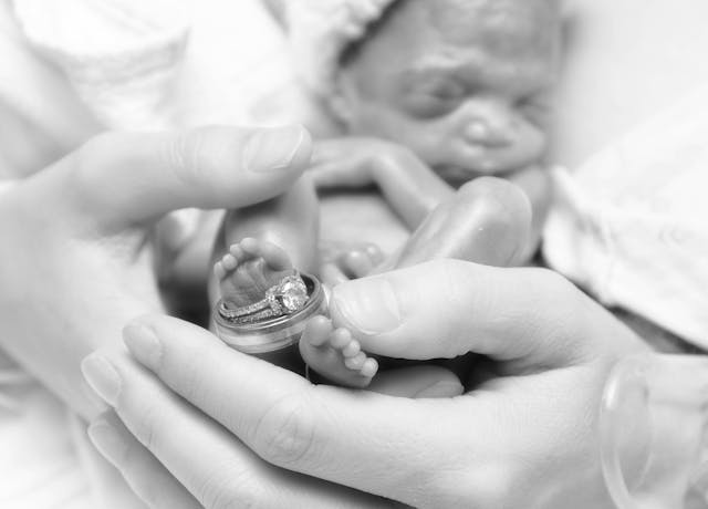 Baby Celeste lived for 22 weeks, but her short life is making an impact image