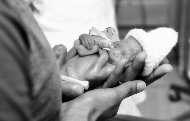 Baby Celeste lived for 22 weeks, but her short life is making an impact image