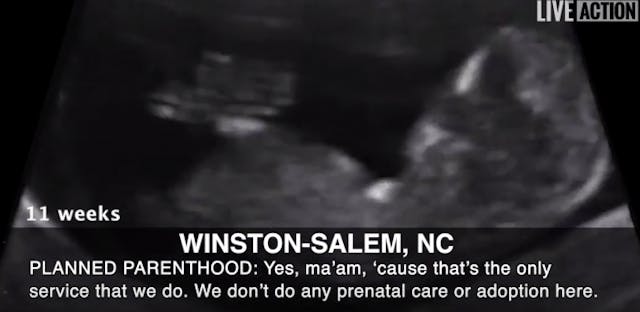 Planned Parenthood: We will only give you an ultrasound if you want an abortion image