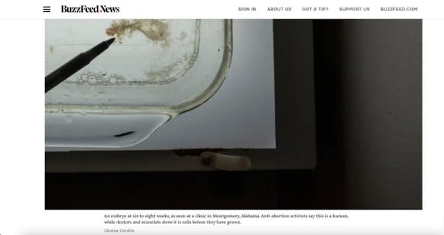 Screenshot: BuzzFeed News BuzzFeed News spreads fake news about abortion and human development image