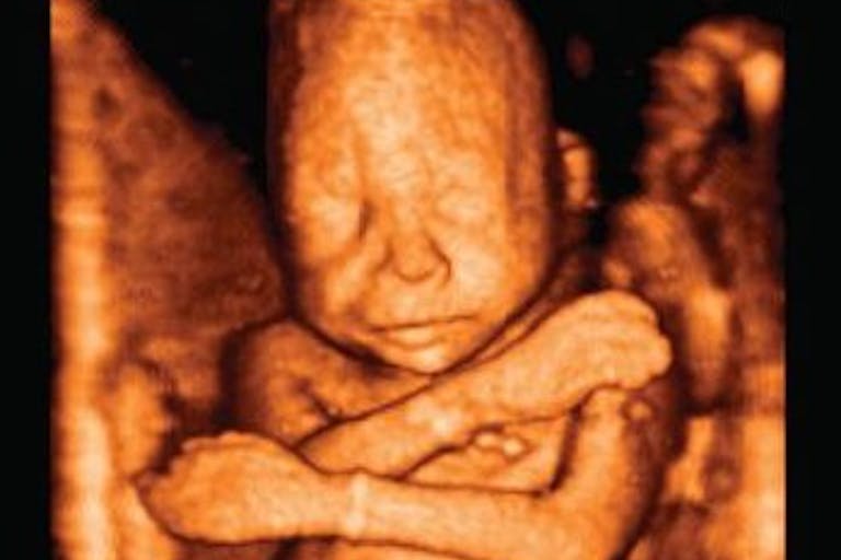 22weekultrasound