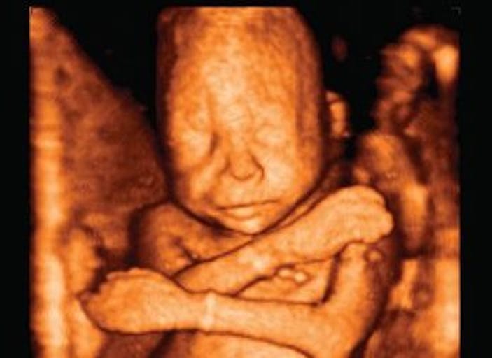 22weekultrasound
