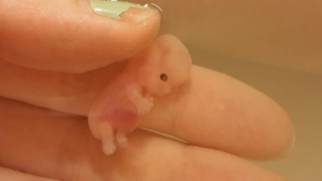 BuzzFeed News spreads fake news about abortion and human development image