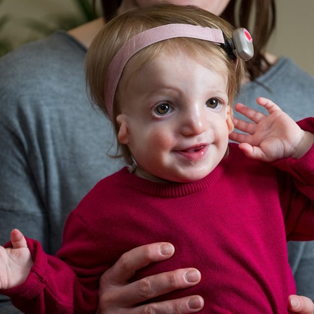 Alice Moore, 13 months who was born with the rare disease Treacher Collins Syndrome. See MASONS story MNFACE: A new dad with a severe facial disfigurement has defended his decision to have a baby daughter with the same condition. Simon Moore, 30, who is also profoundly deaf, has always been bullied and would hide indoors to avoid the stares of strangers. His life changed when his hearing dog Foggy, introduced him to Vicky, 36, at a sign language class five years ago and the pair married in 2012. They wanted a family so started IVF and made the decision to keep baby Alice when tests showed she also had the condition known as Treacher Collins Syndrome (TC). They had been offered a special IVF process which included state-of-the-art preimplantation genetic diagnosis to screen for the TC gene that Simon carried. The treatment would search for and destroy any embryos that carried the faulty gene. But after speaking to their family they opted for traditional IVF because they feared the screening process could leave them with no embryos.