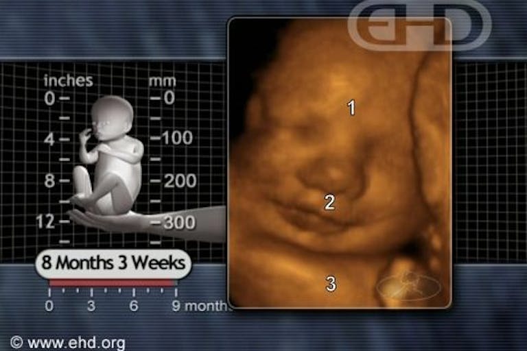 content-before-birth