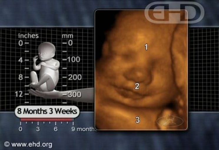 content-before-birth