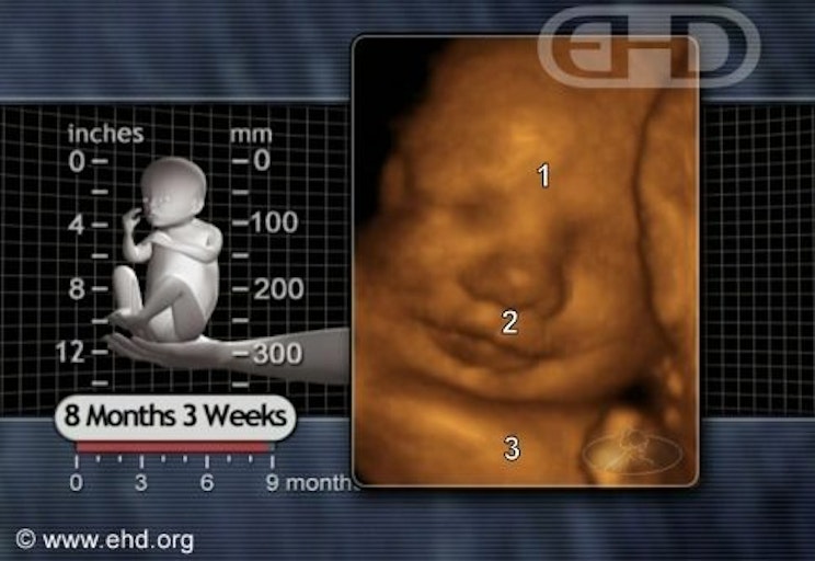 content-before-birth