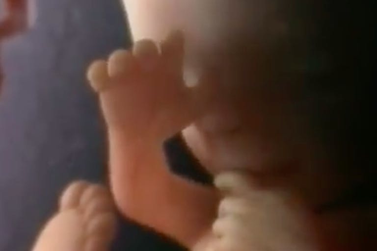 Baby in womb, preborn baby, suck thumb