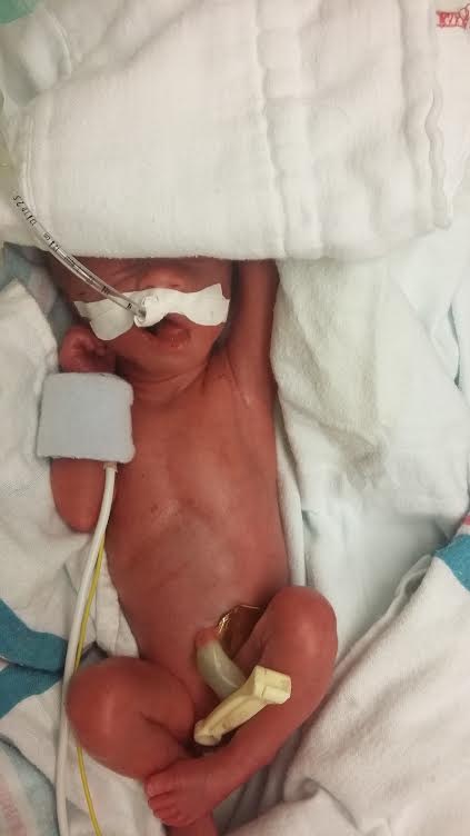 Sophia Rose at 27 weeks