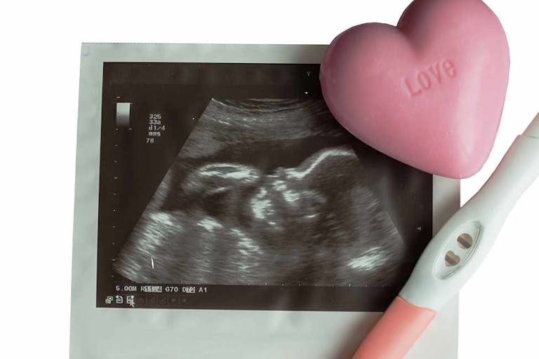 heartbeat, Louisiana, pregnancy