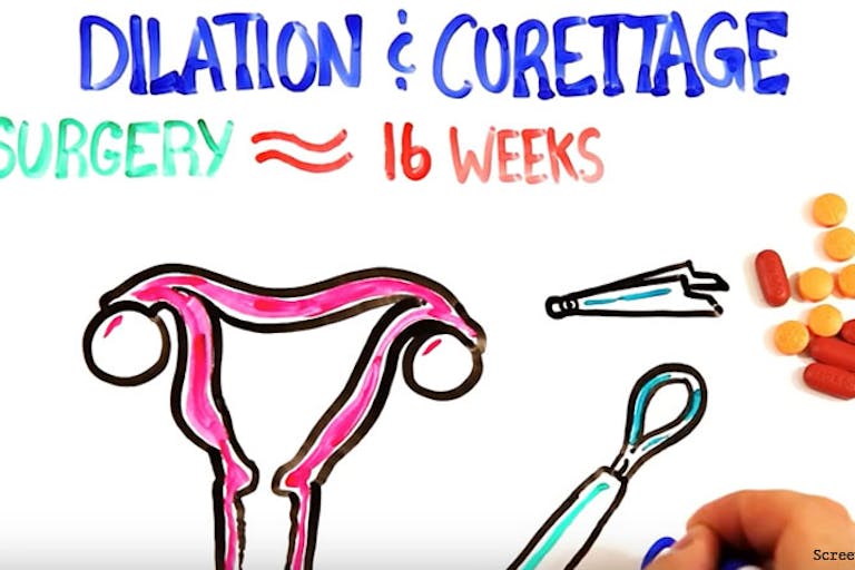 d&c-graphic-pro-abortion-video