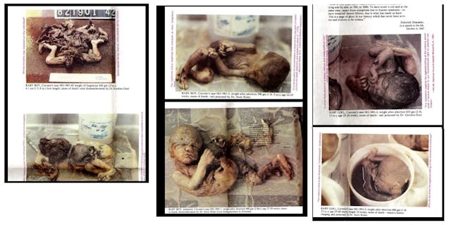 American Holocaust aborted babies found in storage container Image: American Holocaust aborted babies found in storage container