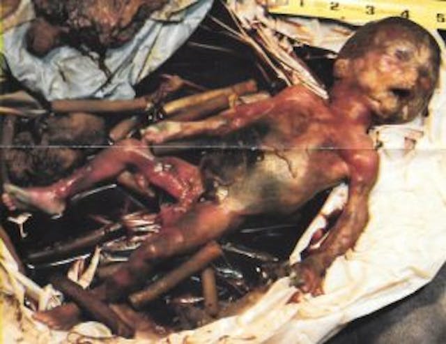 Third trimester aborted babies found in Houston 2 Image: Third trimester aborted babies found in Houston 2