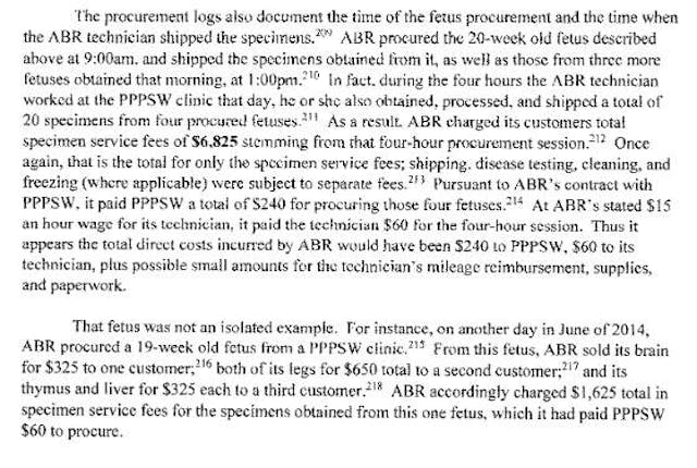 Congressional report: Aborted baby with Down syndrome has brain sold for $325 image