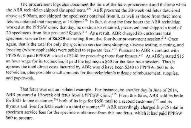 Congressional report: Aborted baby with Down syndrome has brain sold for $325 image