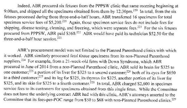 Congressional report: Aborted baby with Down syndrome has brain sold for $325 image