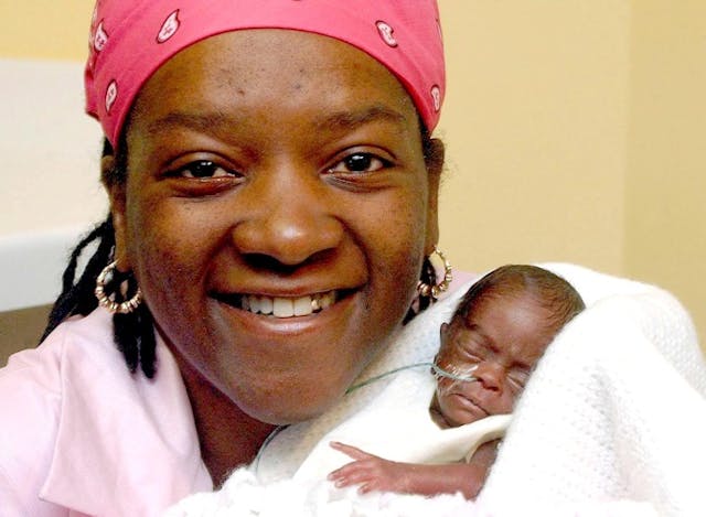 Britain’s smallest baby, Aaliyah Hart, born weighing just 12 ounces, turns 14 image