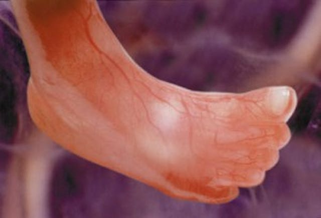 preborn baby's foot at 12 weeks