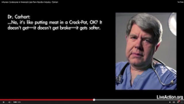 LeRoy Carhart talking about what happens to babies he aborts. LeRoy Carhart